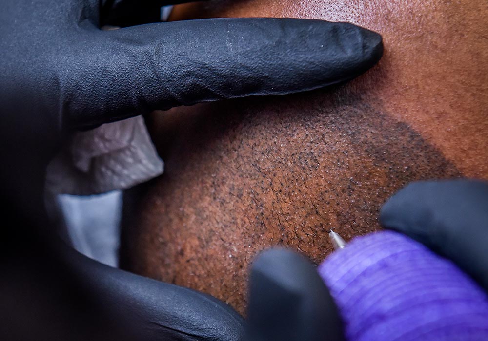 effet crane rasé Micropigmentation pour Homme, DPC BY FRED - Dermopigmentation Capillaire Hommes à Saint-Nazaire