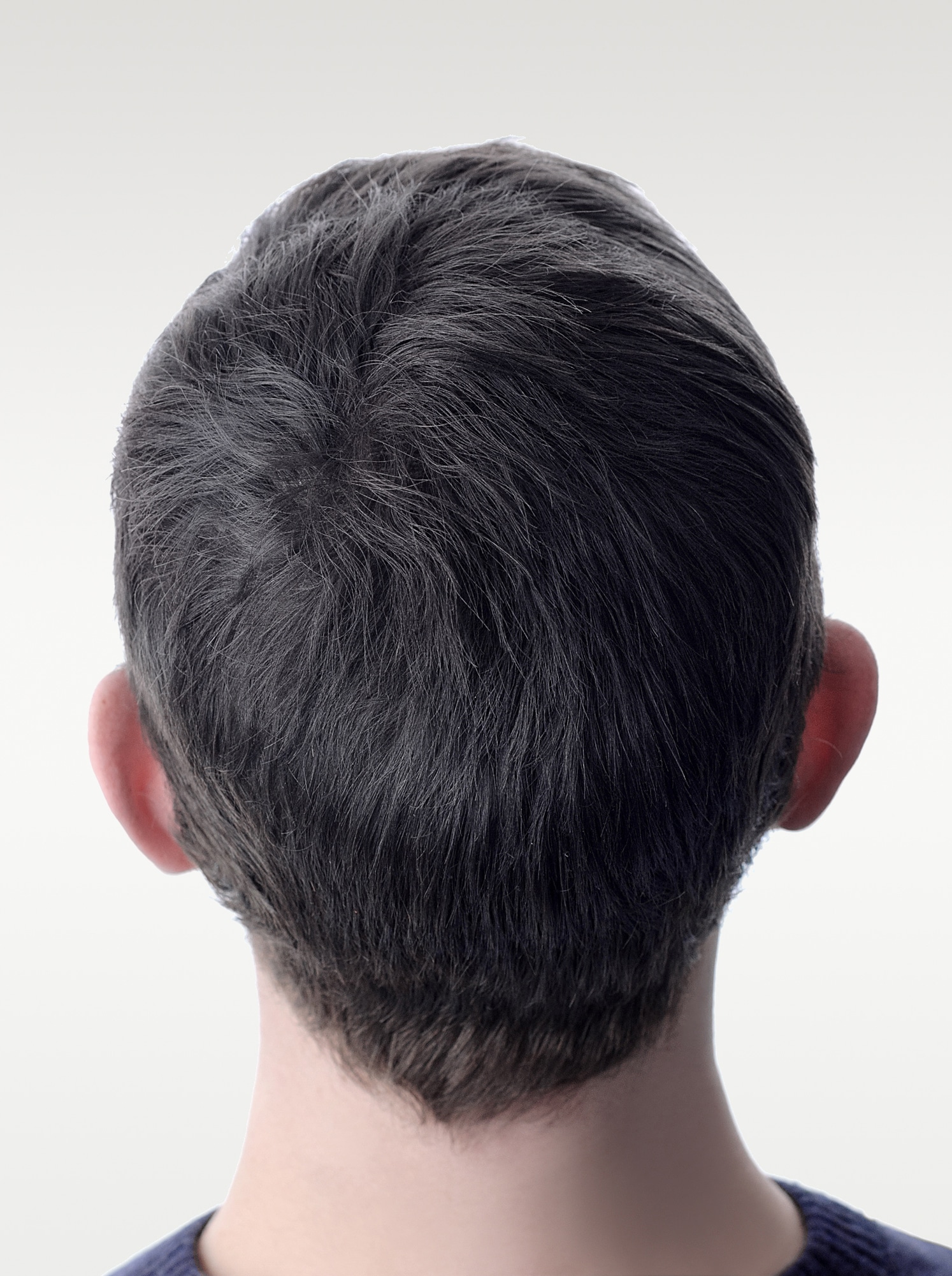 Avant et après Micropigmentation pour Homme, DPC BY FRED - Dermopigmentation Capillaire Hommes à Saint-Nazaire